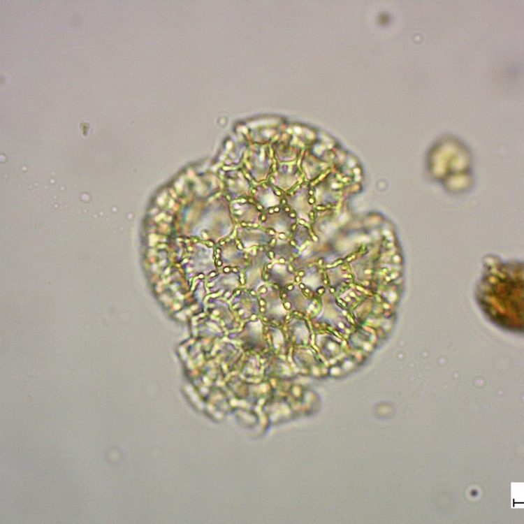 Zoom: 1x / Objective: A-plan 63x/0,8 Pol / MicroscopeName: Giannis